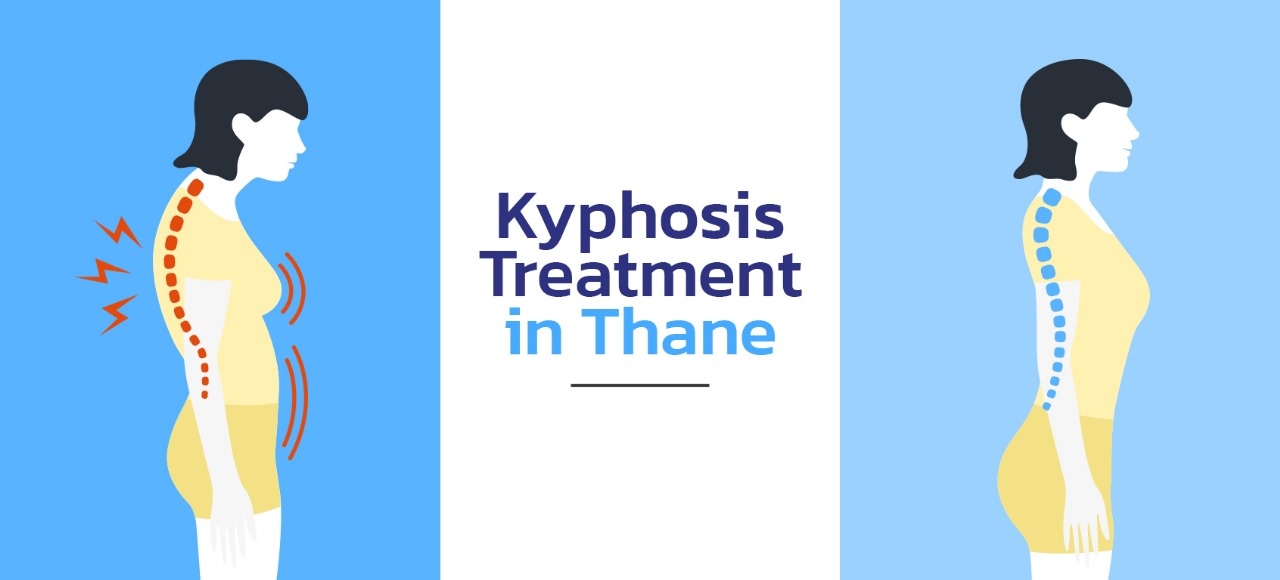 Kyphosis treatment in thane