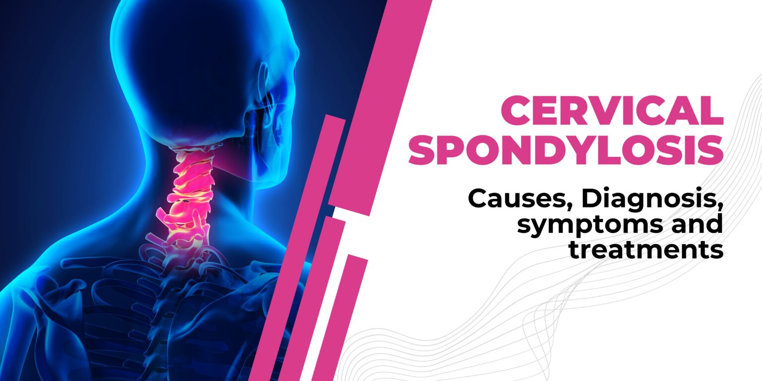 Cervical Spondylosis Treatments