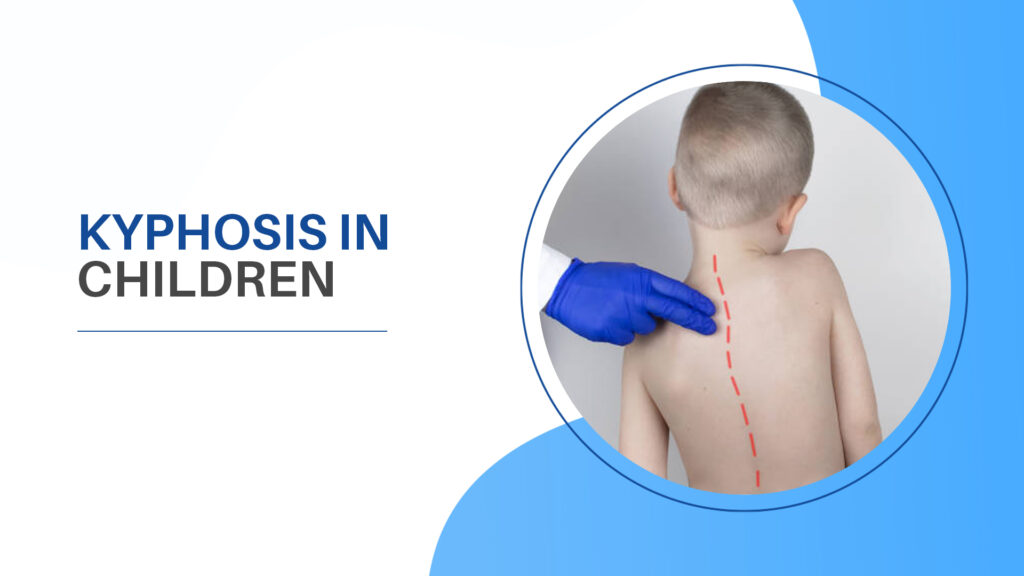 Kyphosis in Children