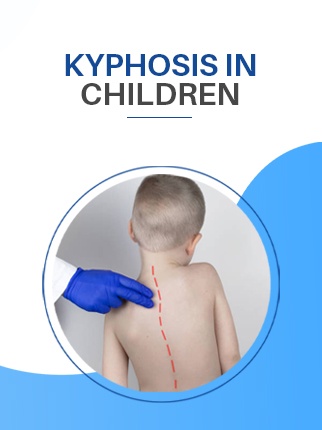 Kyphosis in Children: Causes, Detection, and Treatment
