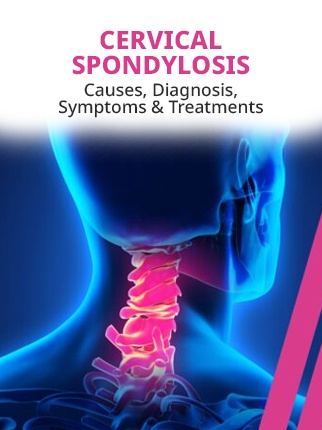 Cervical Spondylosis Treatments