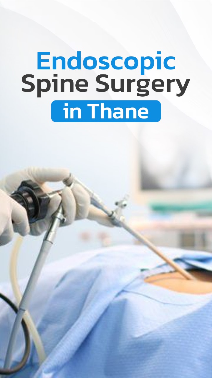 Endoscopic Spine Surgery Thane