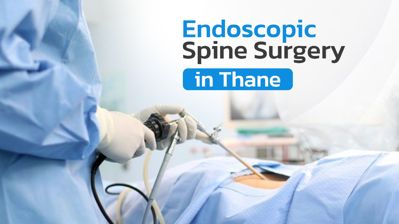 Endoscopic Spine Surgery in Thane