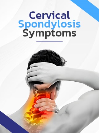 Cervical spondylosis symptoms