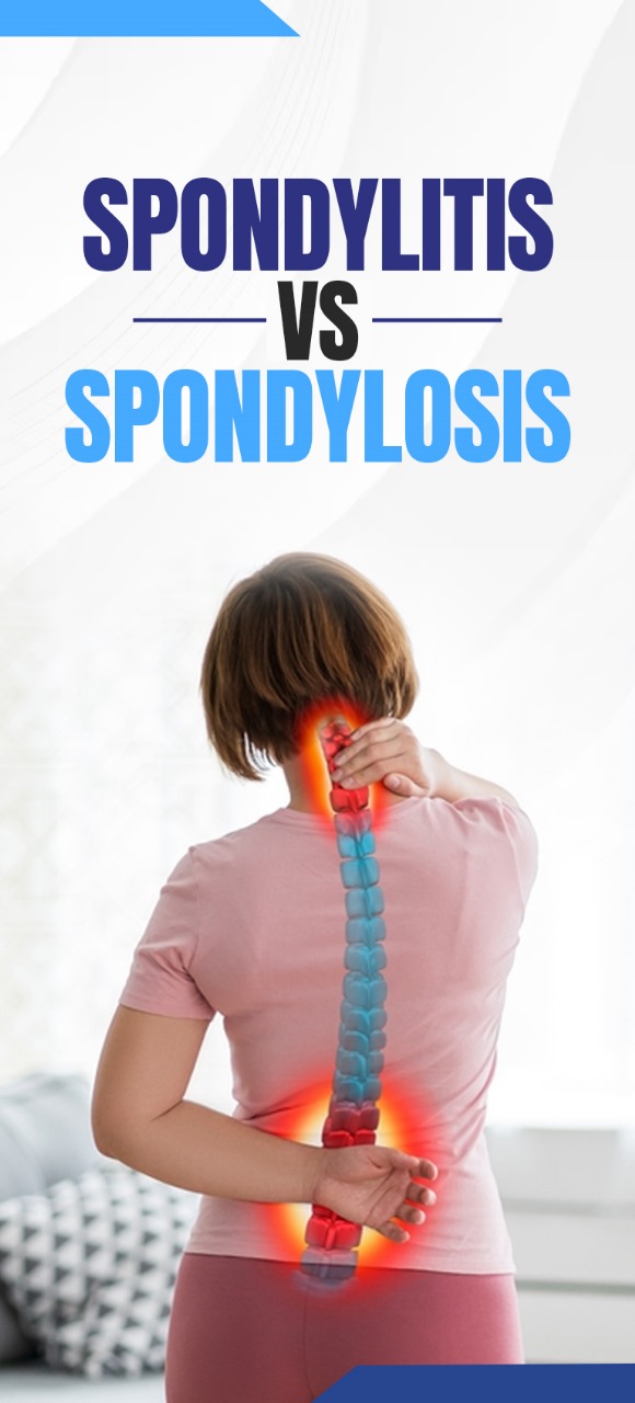 Spondylosis vs Spondylitis - The Spine Clinic